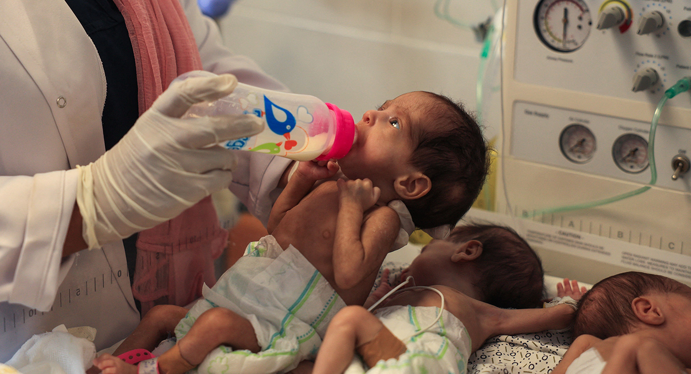 UNRWA: More than 5,800 children suffer from malnutrition in Gaza during June