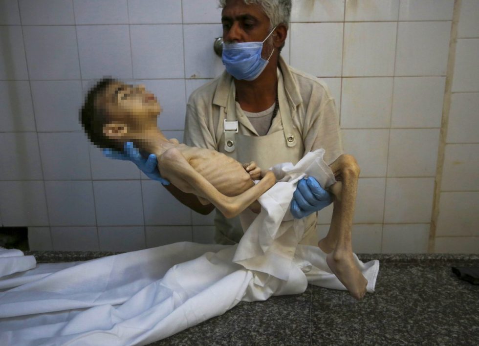 Gaza: Famine claims hundreds of lives, including 69 children