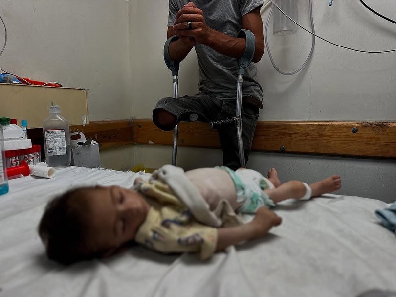 Four Children Die during 24 Hours Due to Famine in Gaza