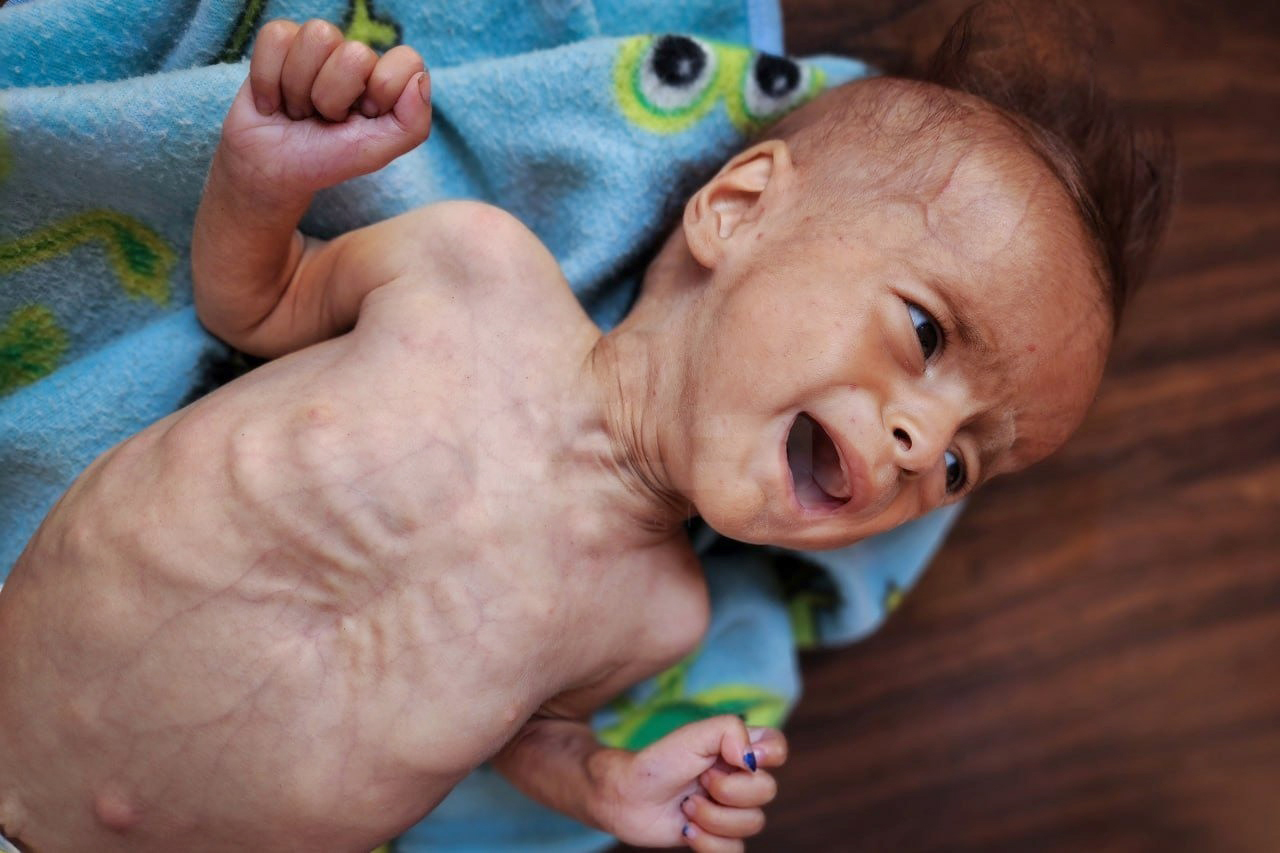 Gaza Media: 100,000 children in Gaza risk hunger to death