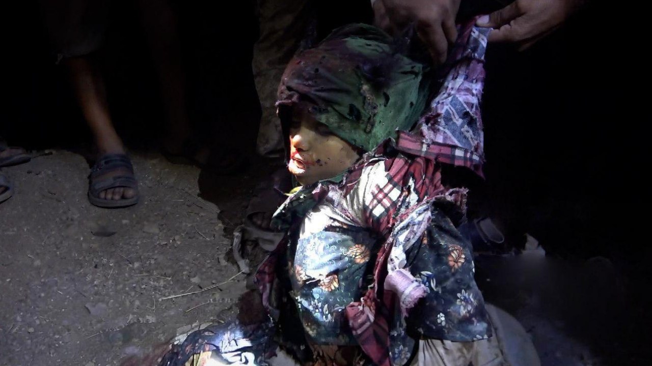 Saudi Cluster Bomb Strike in Dhamar Leaves 20 Dead and Injured