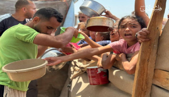 70  ألف طفل بغزة يواجهون مستويات حادة من سوء التغذية