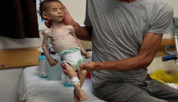 وكالة الأونروا: "إسرائيل" تجوِّع مليون طفل في غزة