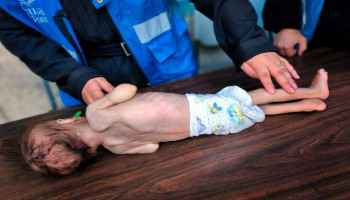 "الأغذية العالمي": شخص من 3 في غزة لا يتناول الطعام أيامًا