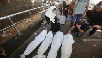 استشهاد طفلة في غزة بسبب الجوع وسوء التغذية