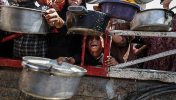 أكثر من 20 ألف طفل نُقلوا للمستشفيات بسبب سوء التغذية الحاد في غزة