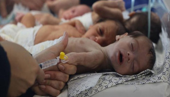 5 وفيات جديدة يرفع حصيلة المجاعة وسوء التغذية بغزة إلى 227 شهيداً