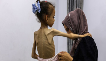 4 وفيات جديدة بالمجاعة في غزة بينهم طفلان ترفع حصيلة ضحايا التجويع إلى 317