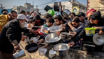 غزة تحت التجويع: ارتفاع وفيات سوء التغذية إلى 428 شهيداً