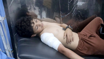 إصابة أربعة أطفال بشظايا قذيفة أطلقها مرتزقة العدوان في وادي صالة بتعز