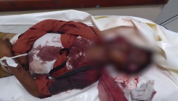 48 شهيدا وجريحا في غارات للعدو السعودي وقصف لأدواته في تعز والجوف