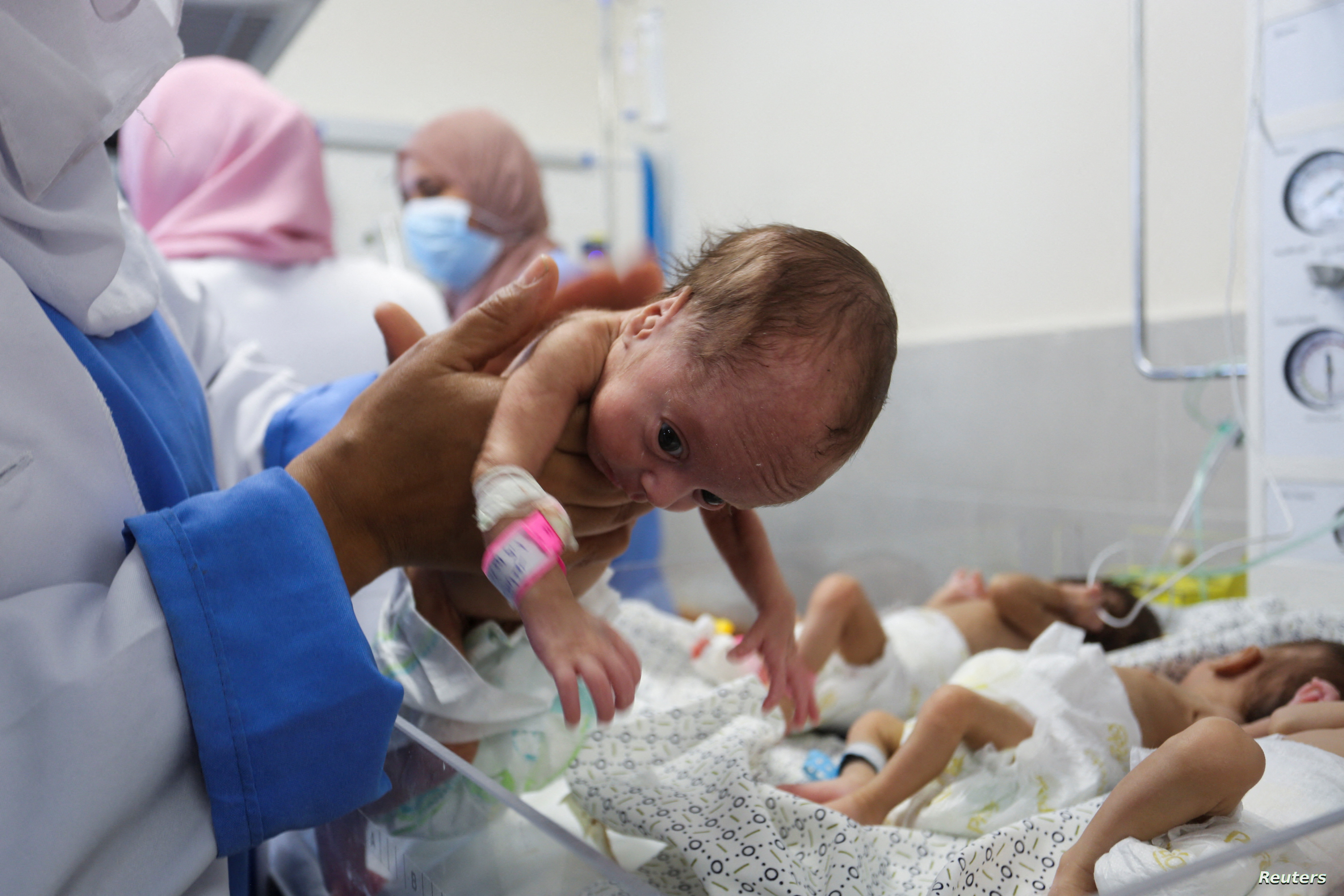 وكالة الأونروا: 66 ألف طفل بغزة يعانون سوء تغذية