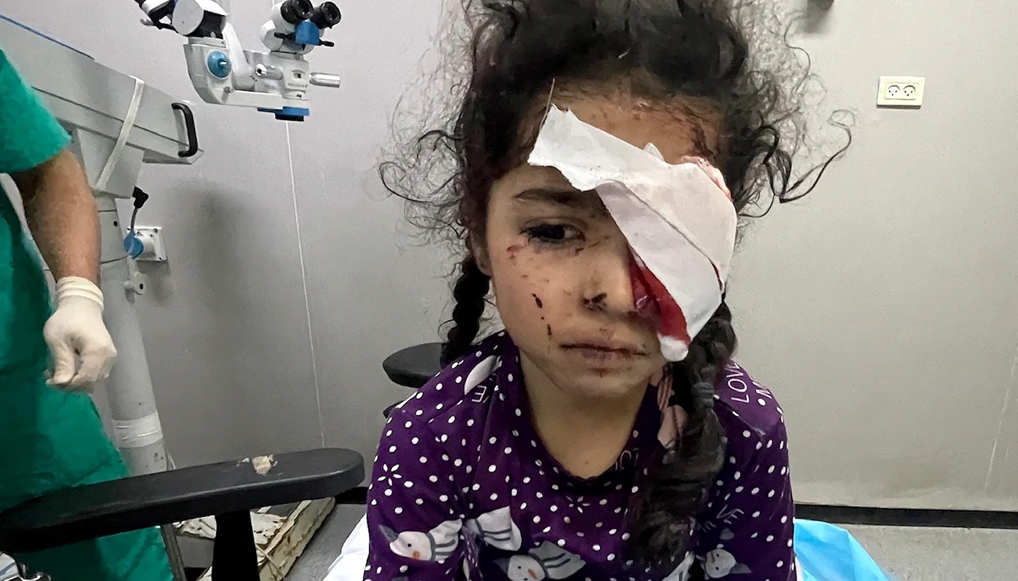 1500 فلسطيني فقدوا البصر بسبب حرب الإبادة على غزة