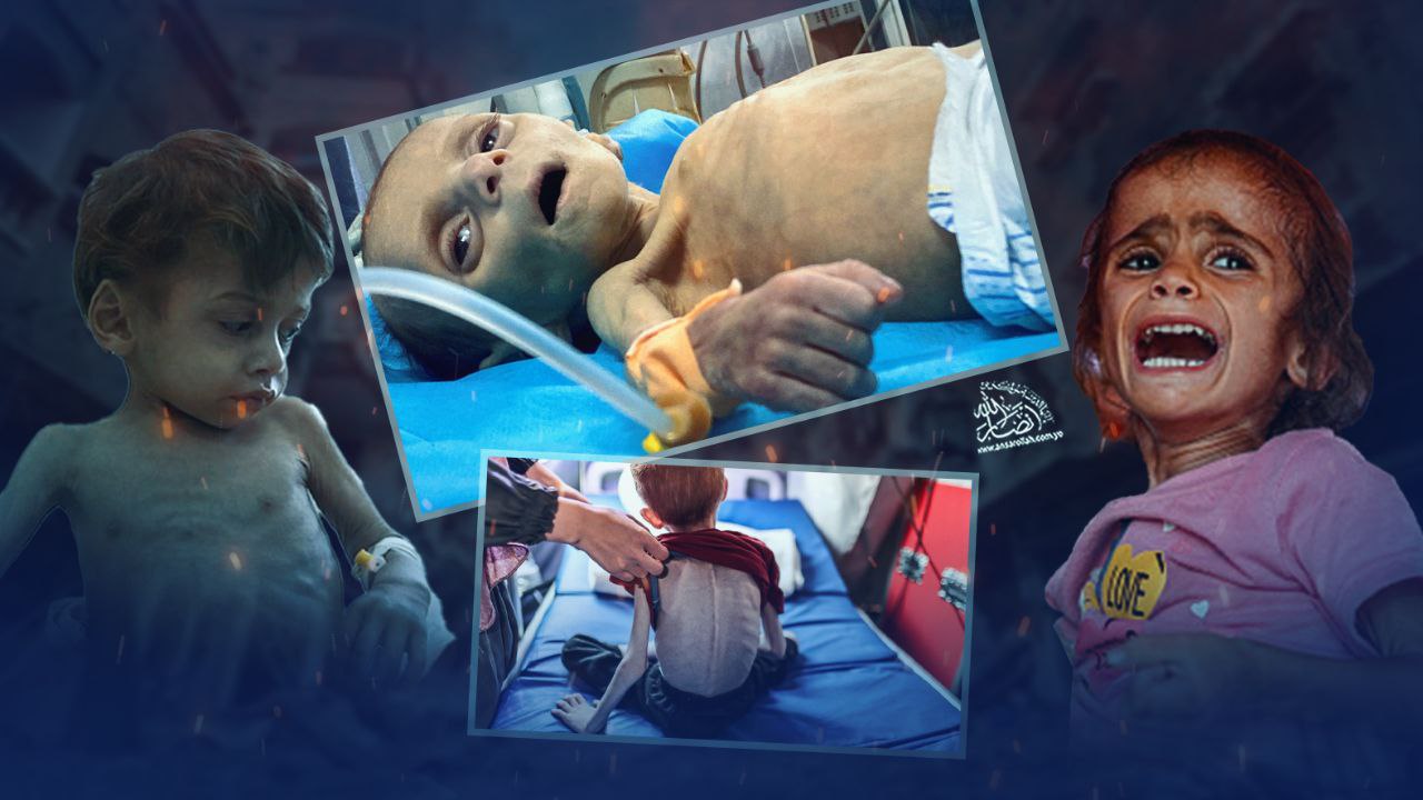 بينما الجوع يفتك بغزة.. أنظمة خليجية تغدق المليارات على المجرم ترامب وتُدير ظهرها لفلسطين