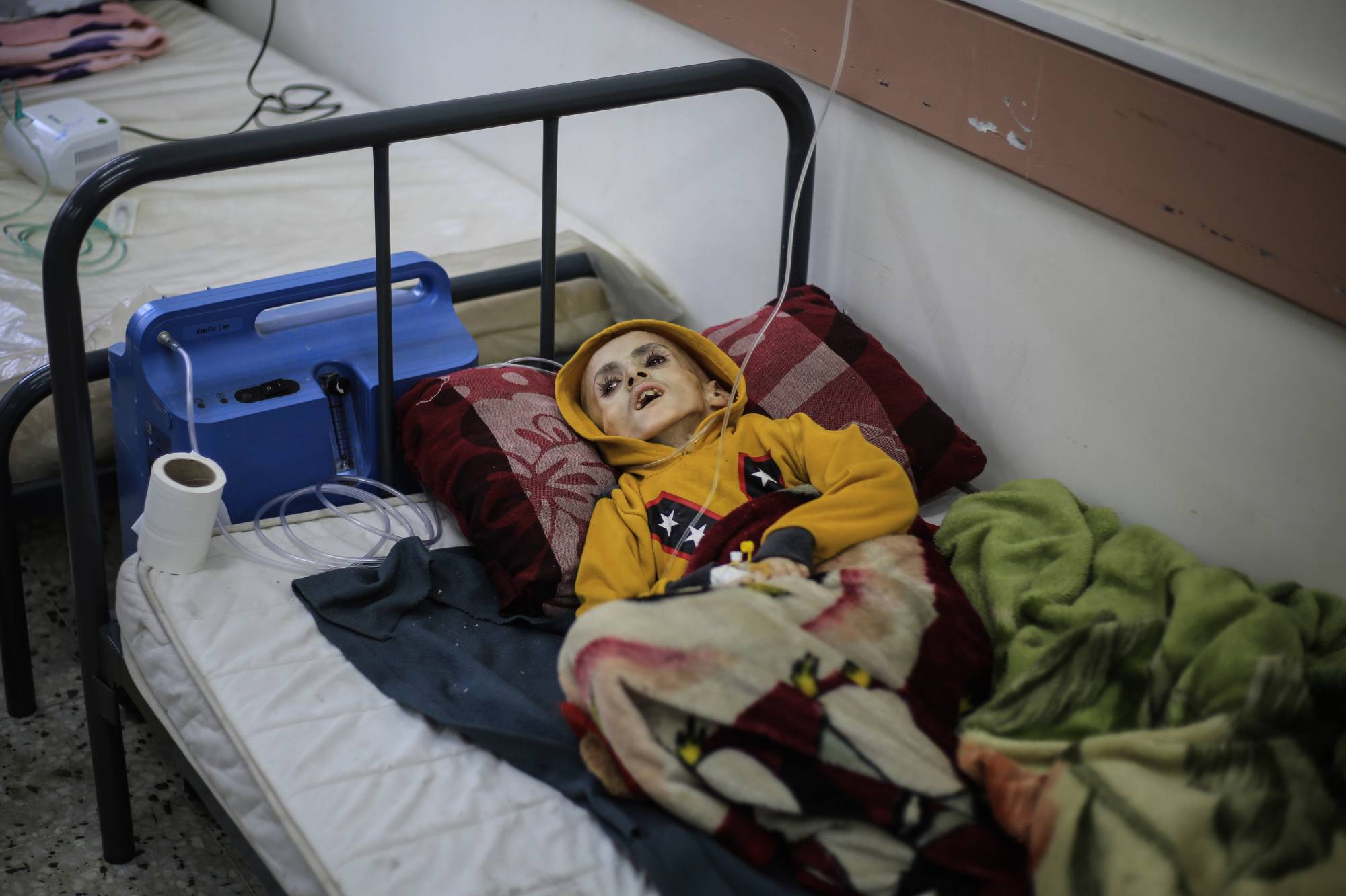 استشهاد طفل فلسطيني في غزة بسبب الجوع