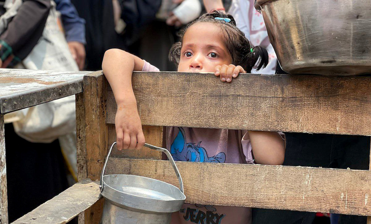 17 ألف طفل في قطاع غزة يعانون من سوء التغذية
