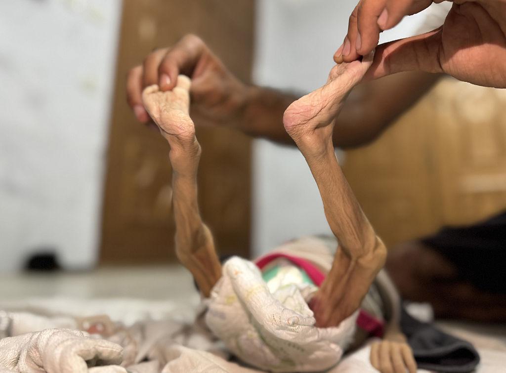 "الأغذية العالمي": ثلث سكان القطاع بلا طعام منذ عدة أيام