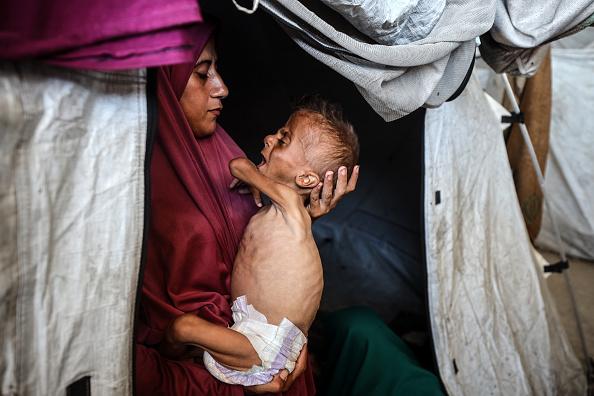 "فايننشال تايمز": العالم خذل الفلسطينيين وتجويع غزة وصمة عار