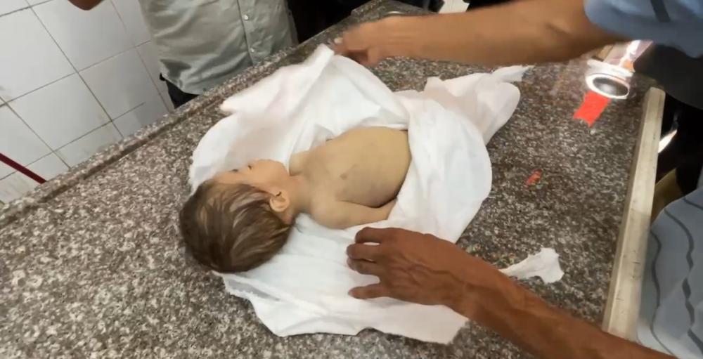 وفاة طفلة بسبب الجوع في غزة