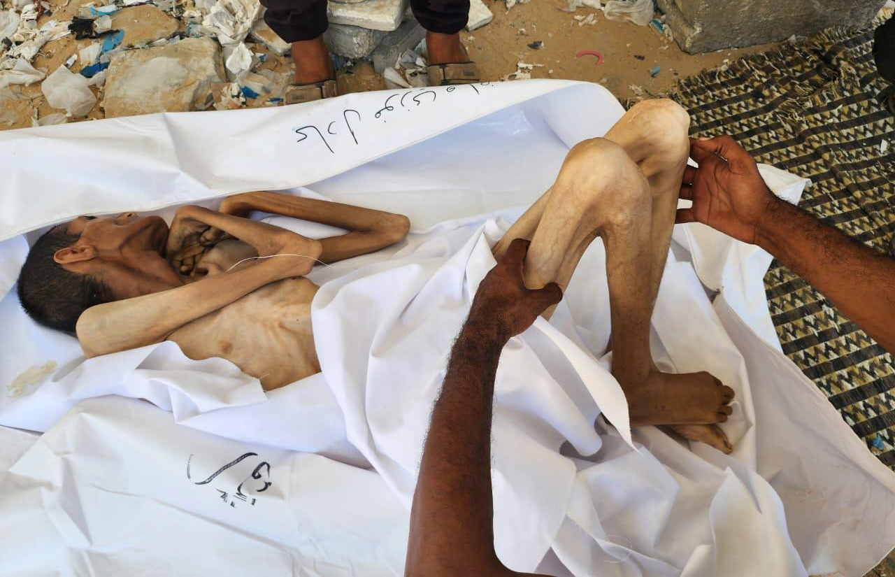 وفاة حالتين يرفع حصيلة شهداء المجاعة بغزة إلى 159 شهيداً