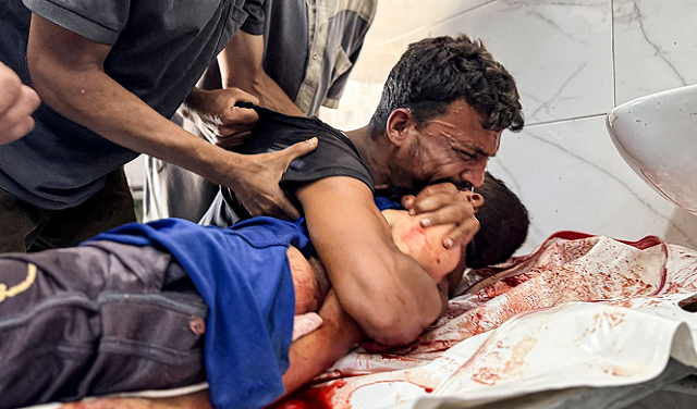 طبيب بريطاني: غزة تواجه همجية من العصور الوسطى