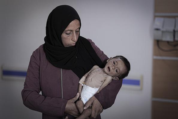 مدير مستشفى ناصر: الأطفال في غزة سيحتاجون وقتا طويلا للتعافي