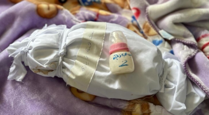 منظمة الصحة العالمية: وفيات سوء التغذية بغزة تشهد ارتفاعا مقلقا