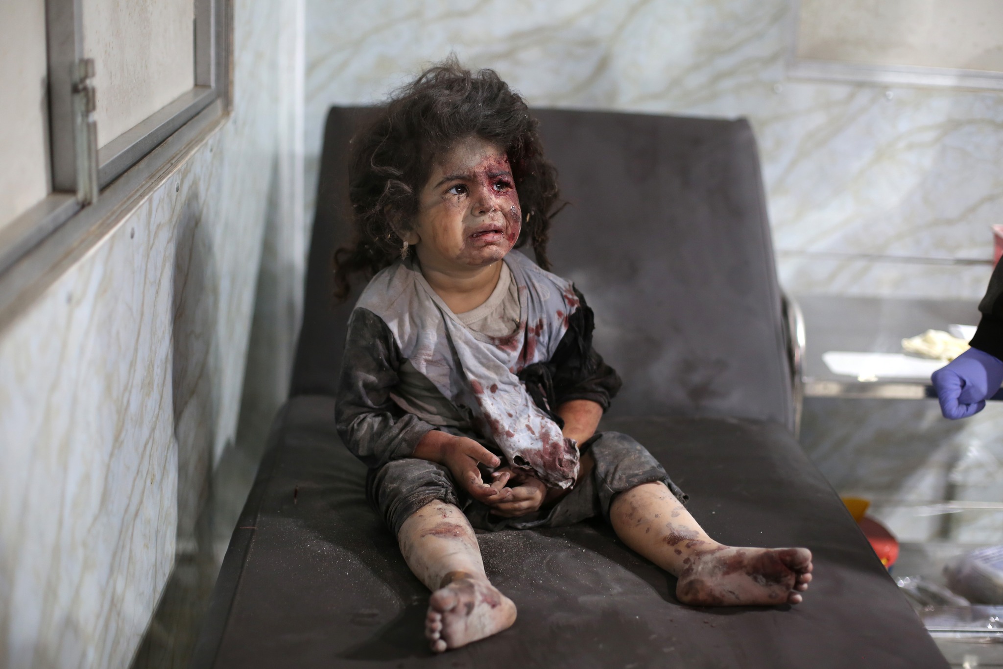 مفوض أممي: غزة تواجه أخطر صدمة نفسية ومعاناة جماعية