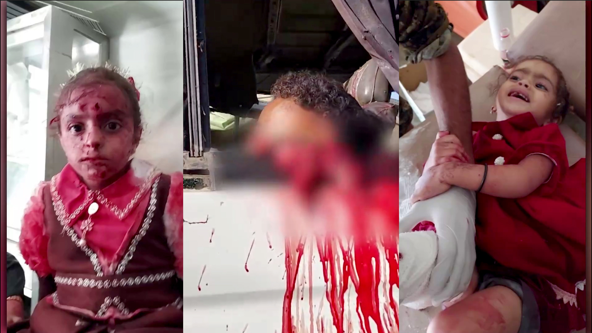 حصيلة العدوان السعودي تبلغ 419 شهيدًا وجريحًا منذ الثالث من سبتمبر الماضي